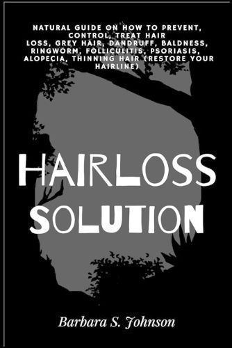 Hairloss Solution By Johnson 9781685220372 (Paperback)