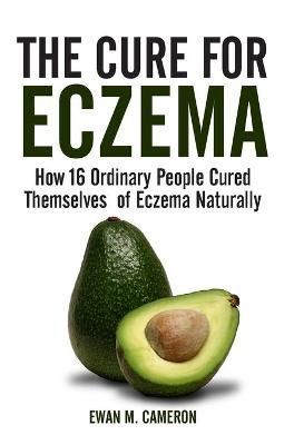 The Cure for Eczema By CAMERON, EWAN M. 9781785550393 (Hardback)