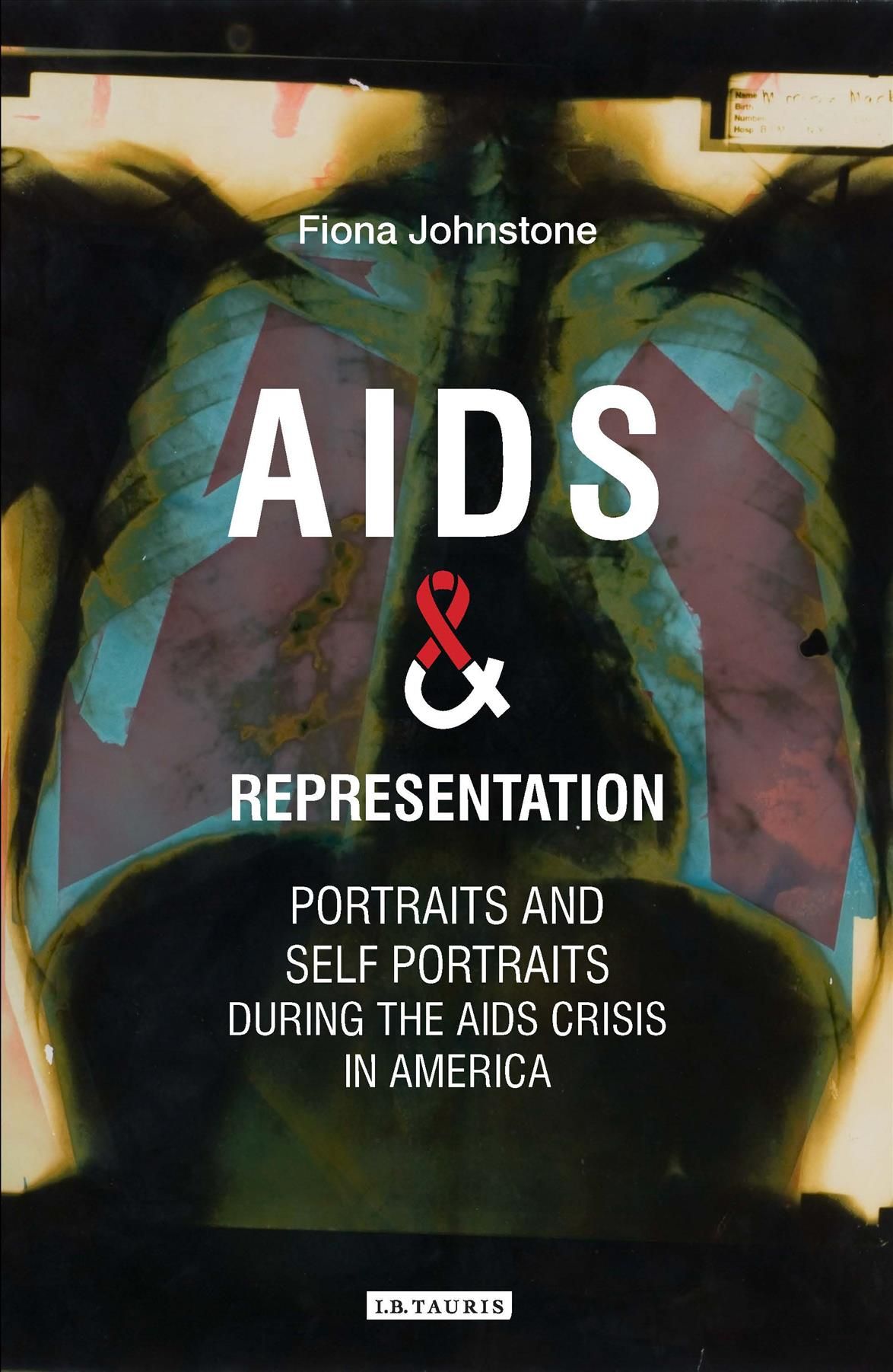 AIDS and Representation By Fiona Johnstone 9781788311885 (Hardback)