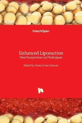 Enhanced Liposuction By Diane Irvine Duncan 9781839628238 (Hardback)