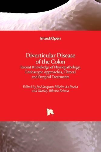 Diverticular Disease of the Colon By José Joaquim Ribeiro da Rocha