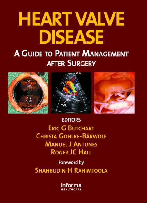 Heart Valve Disease 9781842143087 (Hardback)