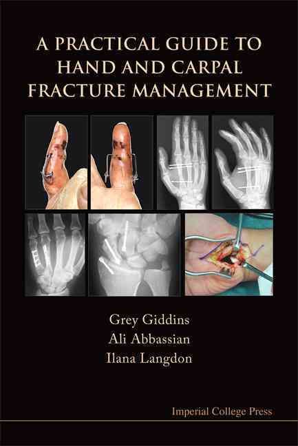 A Practical Guide to Hand and Carpal Fracture Management 9781848162617