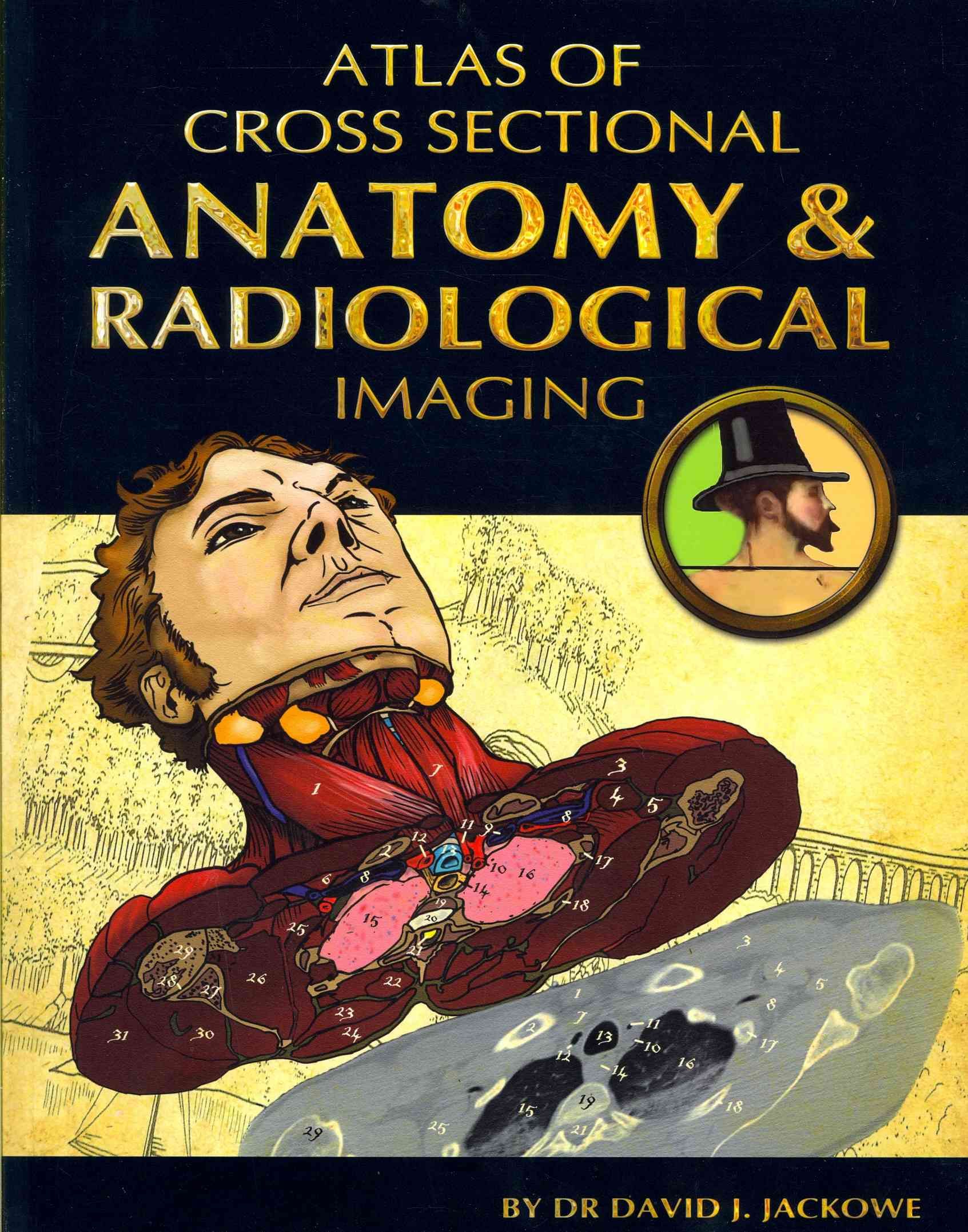 Atlas of Cross Sectional Anatomy and Radiological Imaging (Paperback)