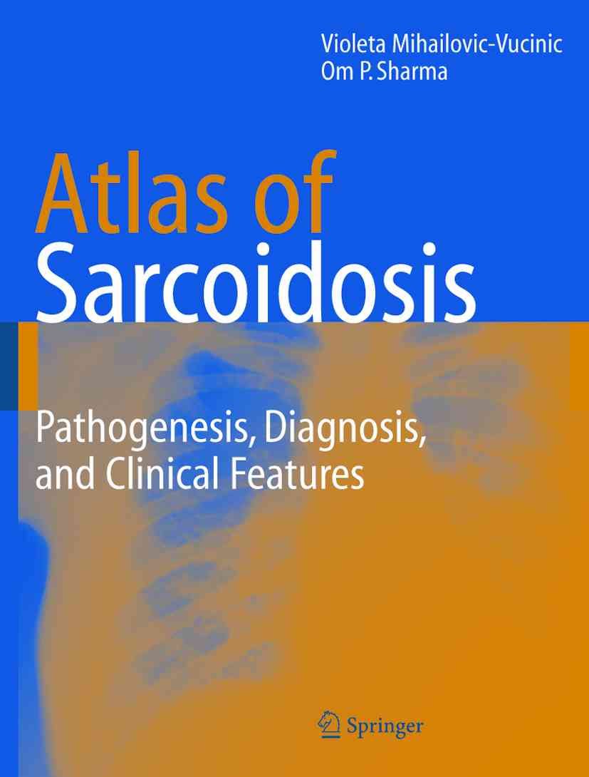 Atlas of Sarcoidosis By Violeta Mihailovic-Vucinic, Om P. Sharma