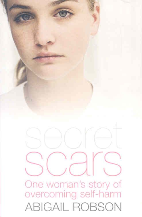 Secret Scars By Robson, Abigail 9781850787211 (Paperback)