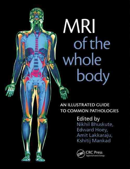 MRI of the Whole Body By Kshitij Mankad 9781853157769 (Paperback)