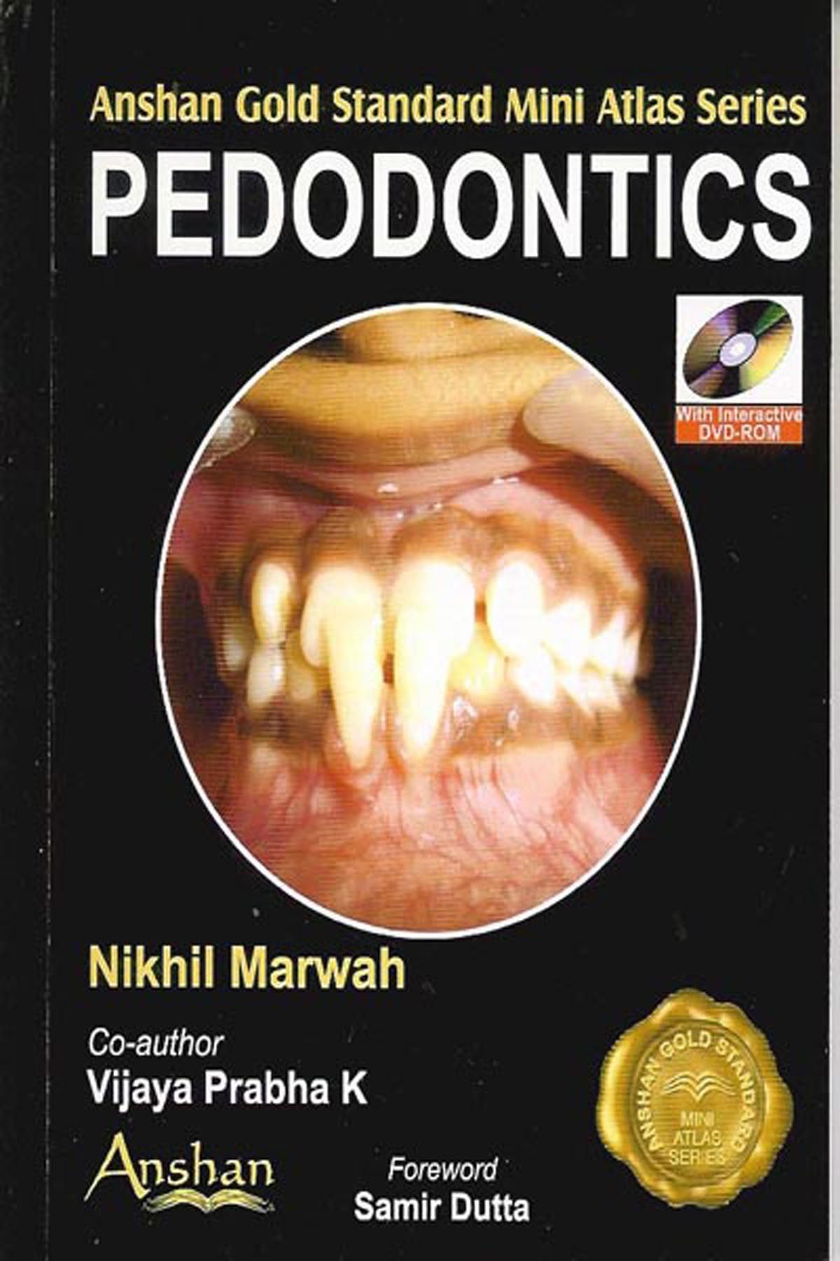 Mini Atlas of Pedodontics By Nikhil Marwah 9781905740413