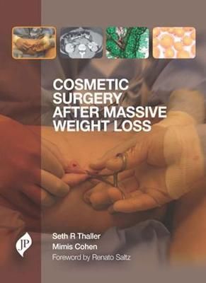 Cosmetic Surgery After Massive Weight Loss 9781907816284 (Hardback)