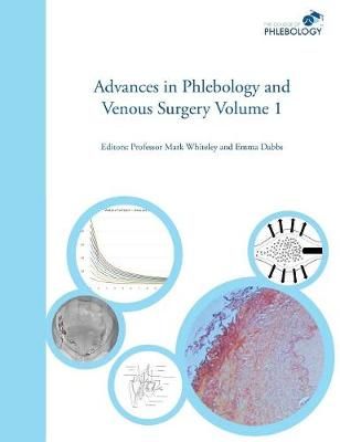 Advances in Phlebology and Venous Surgery Volume 1 By Whiteley, Mark S
