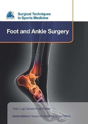 Foot and Ankle Surgery 9781909836341 (Hardback)