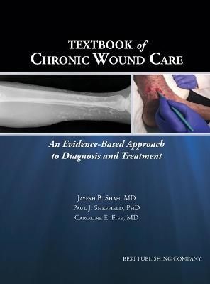 Textbook of Chronic Wound Care 9781947239074 (Hardback)