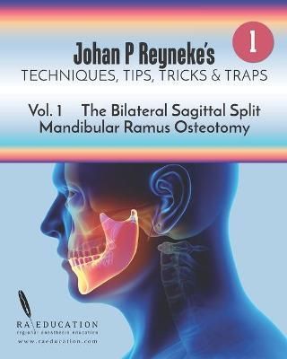Johan P Reyneke's Techniques, Tips, Tricks and Traps 9781948083157