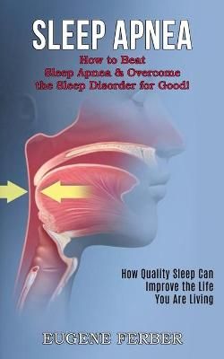 Sleep Apnea By Eugene Ferber 9781990268366 (Paperback)