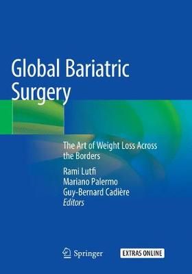 Global Bariatric Surgery 9783030066819 (Paperback)
