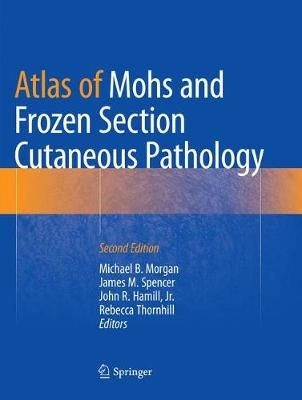Atlas of Mohs and Frozen Section Cutaneous Pathology 9783030090906