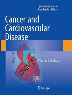 Cancer and Cardiovascular Disease 9783030096694 (Paperback)