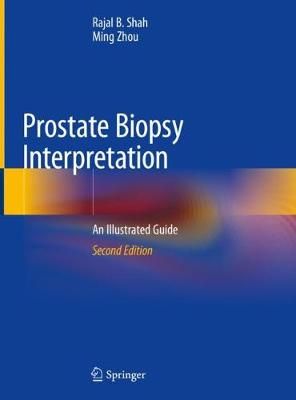 Prostate Biopsy Interpretation By Rajal B. Shah, Ming Zhou (Hardback)