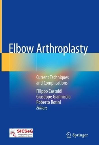 Elbow Arthroplasty 9783030144548 (Hardback)