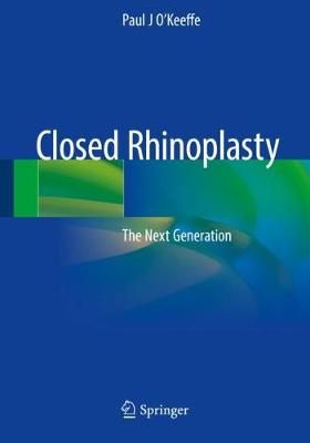 Closed Rhinoplasty By Paul J O'Keeffe 9783030168544 (Paperback)