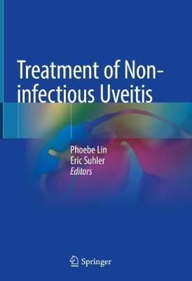 Treatment of Non-Infectious Uveitis 9783030228255 (Hardback)