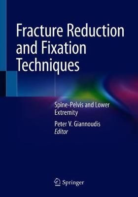 Fracture Reduction and Fixation Techniques 9783030246075 (Hardback)