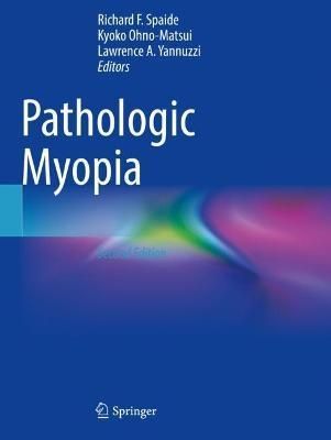 Pathological Myopia 9783030743369 (Paperback)