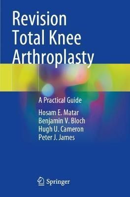 Revision Total Knee Arthroplasty 9783030812874 (Paperback)