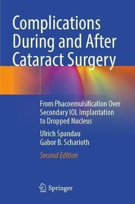 Complications During and After Cataract Surgery 9783030935337