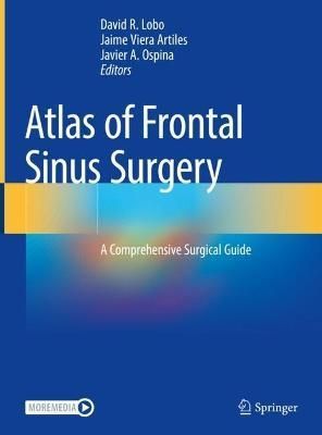 Atlas of Frontal Sinus Surgery 9783030981273 (Hardback)