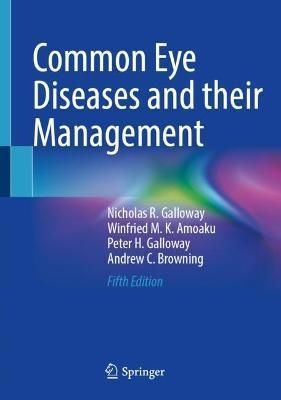 Common Eye Diseases and Their Management 9783031084492 (Hardback)