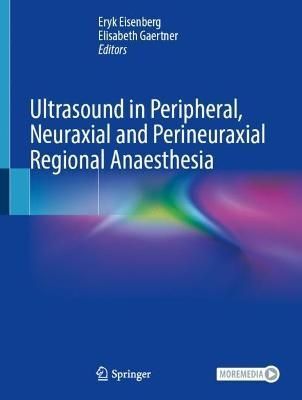 Ultrasound in Peripheral, Neuraxial and Perineuraxial Regional Anaesthesia