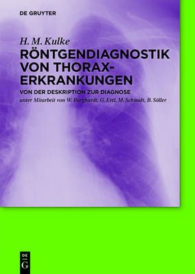 Röntgendiagnostik von Thoraxerkrankungen By Kulke, H. M. (Hardback)