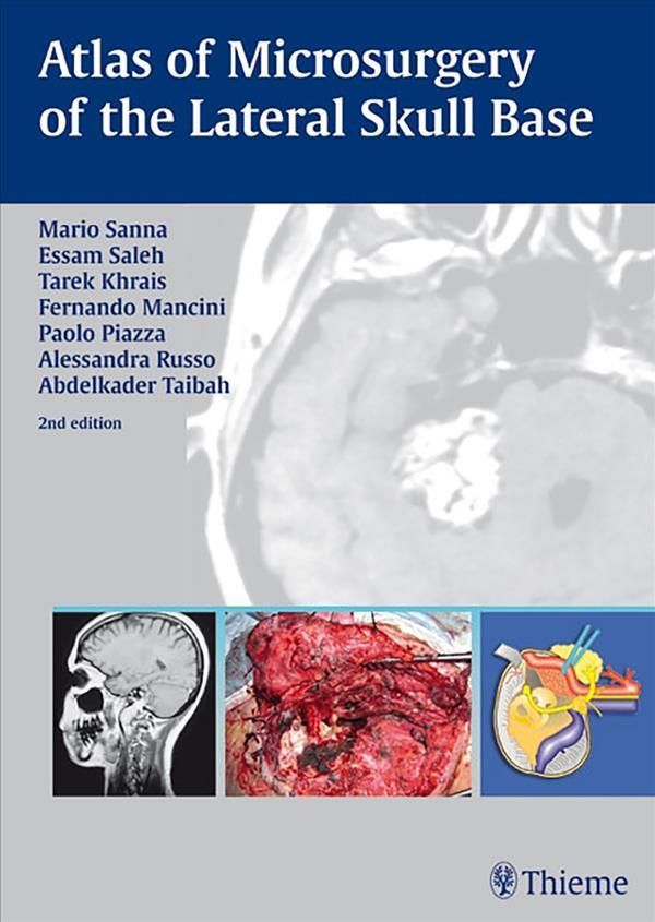 Atlas of Microsurgery of the Lateral Skull Base By Mario Sanna