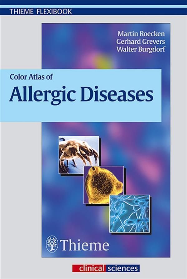 Color Atlas of Allergic Diseases 9783131291912 (Paperback)