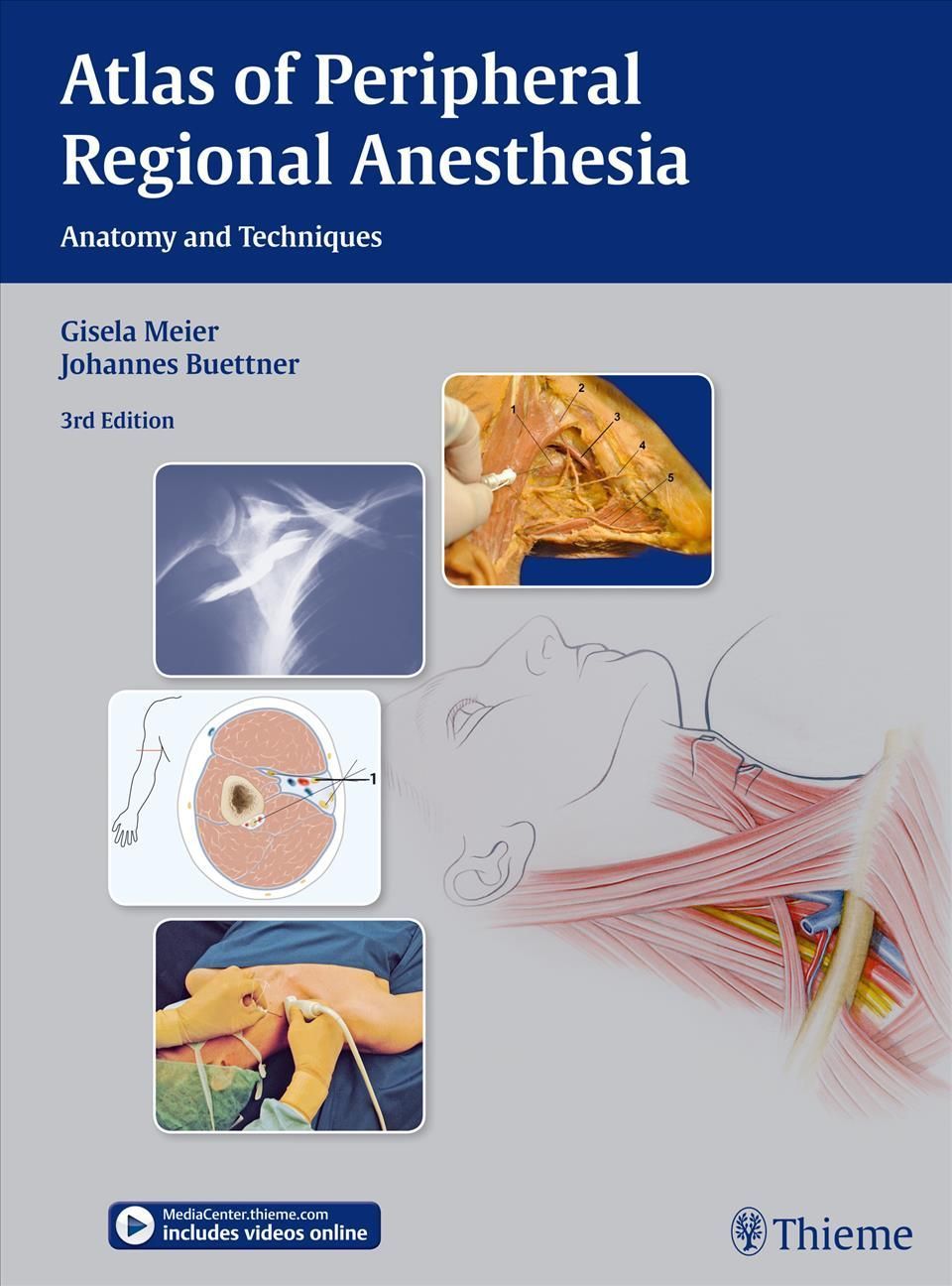 Atlas of Peripheral Regional Anesthesia 9783131397935 (Hardback)