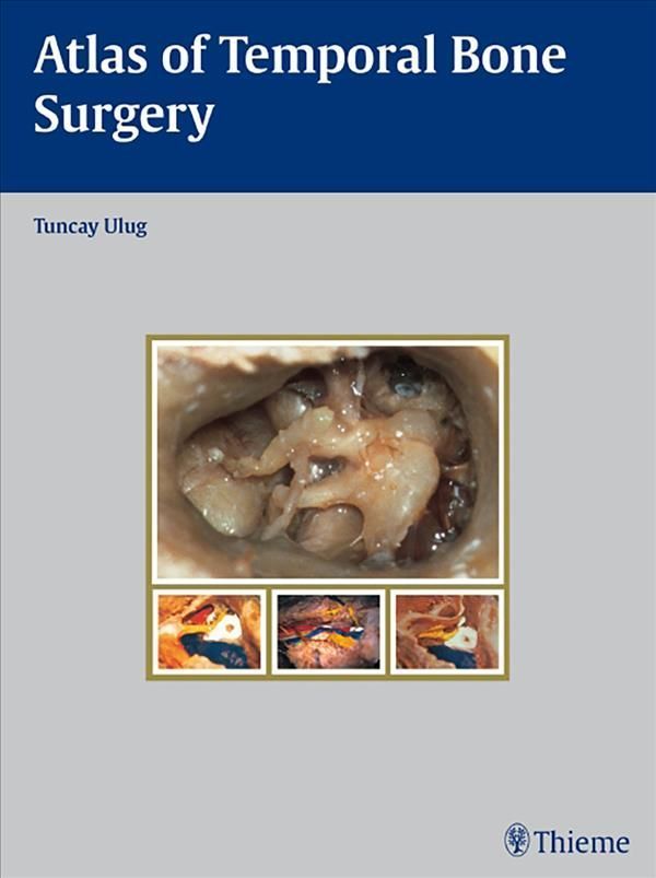 Atlas of Temporal Bone Surgery By Tuncay Ulug 9783131471512 (Hardback)
