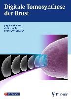 Digitale Tomosynthese der Brust 9783131708915 (Hardback)