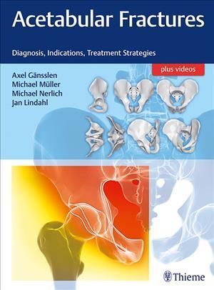 Acetabular Fractures 9783132415607 (Hardback)