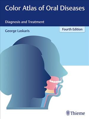 Color Atlas of Oral Diseases By George Laskaris 9783137170044