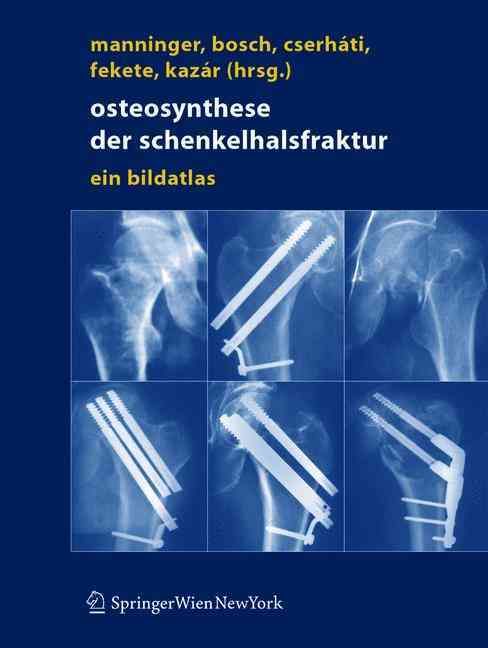 Osteosynthese Der Schenkelhalsfraktur 9783211201527 (Hardback)
