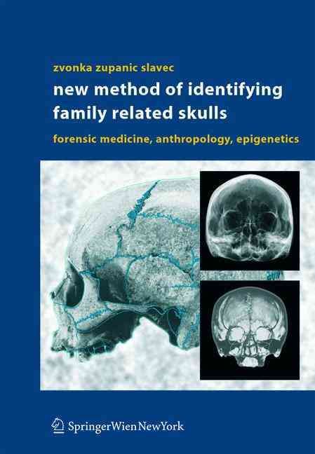 New Method of Identifying Family Related Skulls 9783211220443