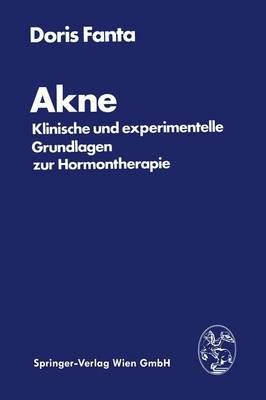 Akne By Doris Fanta 9783211814802 (Paperback)