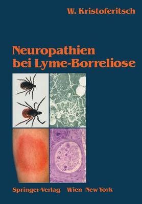 Neuropathien Bei Lyme-Borreliose 9783211821084 (Paperback)