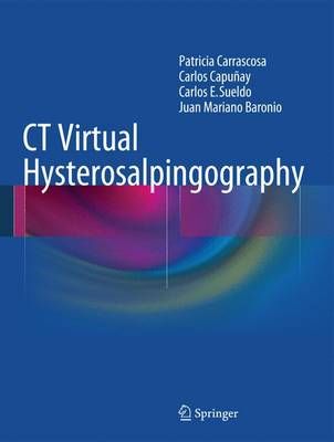 CT Virtual Hysterosalpingography 9783319075594 (Hardback)