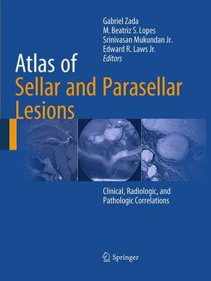 Atlas of Sellar and Parasellar Lesions 9783319342719 (Paperback)