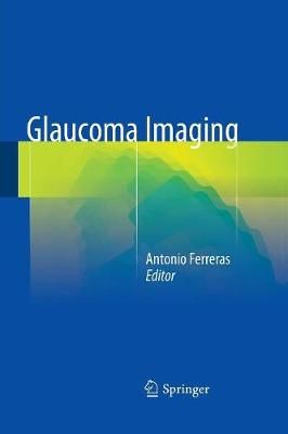 Glaucoma Imaging By Antonio Ferreras (editor) 9783319365633