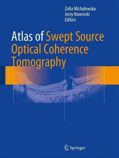 Atlas of Swept Source Optical Coherence Tomography 9783319498393