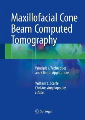 Maxillofacial Cone Beam Computed Tomography 9783319620596 (Hardback)