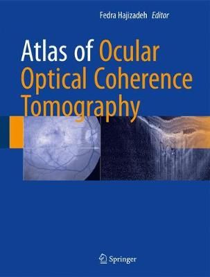 Atlas of Ocular Optical Coherence Tomography 9783319667560 (Hardback)